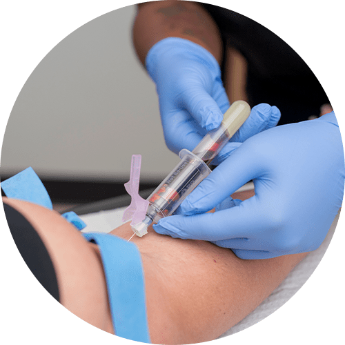 blood allergy testing