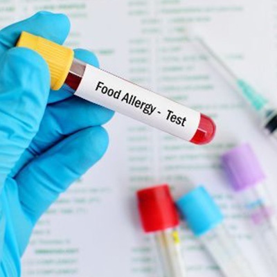 blood allergy testing