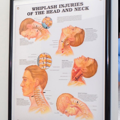 Whiplash and neck injury diagram
